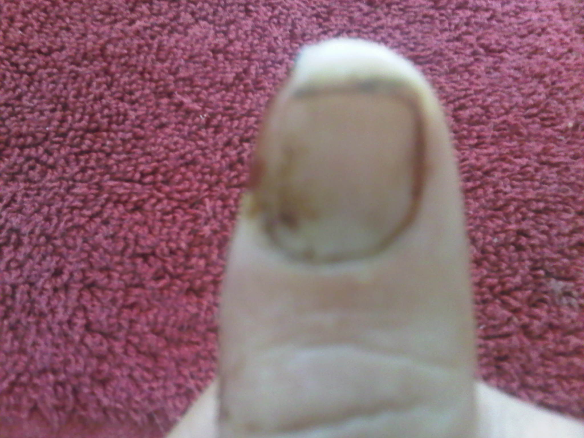thumb front view
